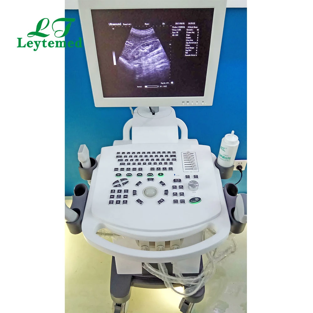 Ltub48V Middle-End PC baseado Carrinho Bw Veterinário scanner de ultra-som para o Hospital de PET