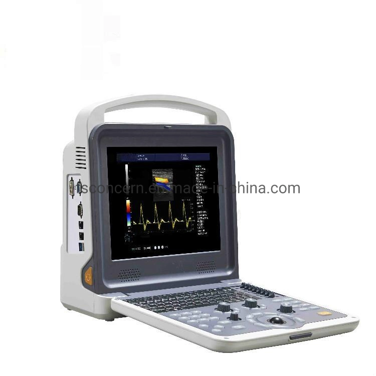 Hospital Medical Factory Price Portable Cardiac Ultrasound Echo Scanner Machine