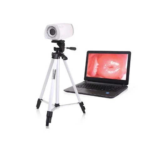 Medizinische Geräte Gynäkologie Untersuchung Digital Video Colposkop Tragbares Vaginal Endoskop Kolposkop-Kamera