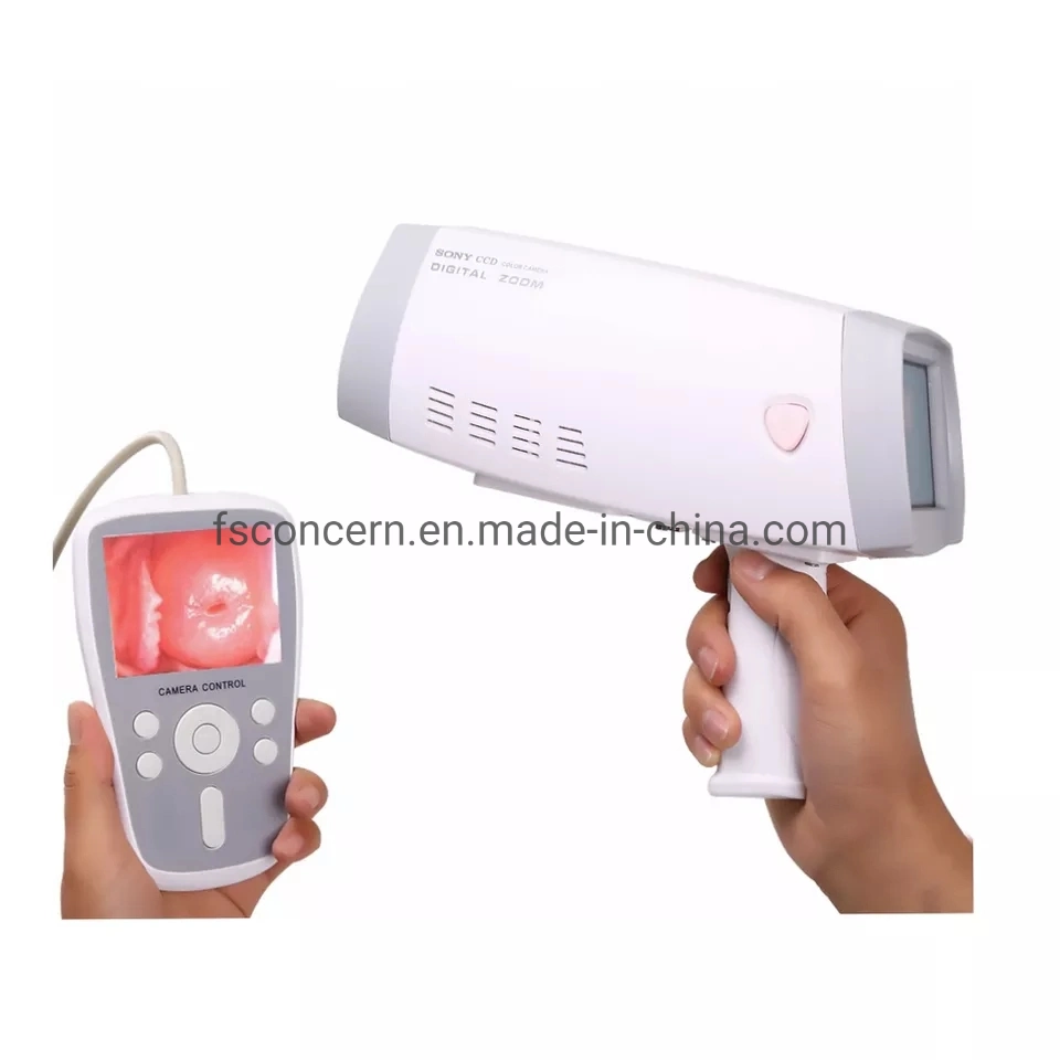 Medical LED Video Colposcopio vagina Ginecología Digital Cámara de luz fría Sistema portátil Colposcopio máquina