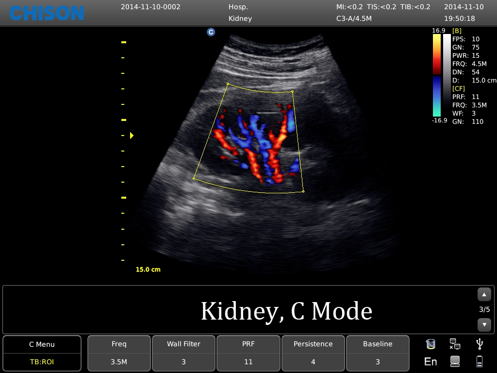 Chiosn EBIT 60 Ecografo Portable Color Doppler System für Geburtshilfe/Gynäkologie, Urologie, Kardio, Rektum, Kinder, Orthopädische Ebit50 Ebit60