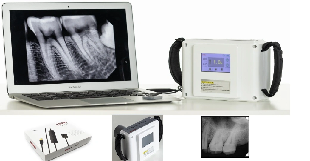 Dental Portátil Digital Wireless unidade de raios X com X Sensor de raios x