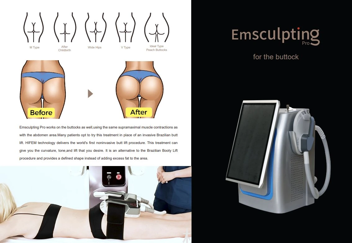 EMS Beauty Equipment Abnehmen Körperformen Cellulite Verlust Maschine Muskel Stimulationsgebäude