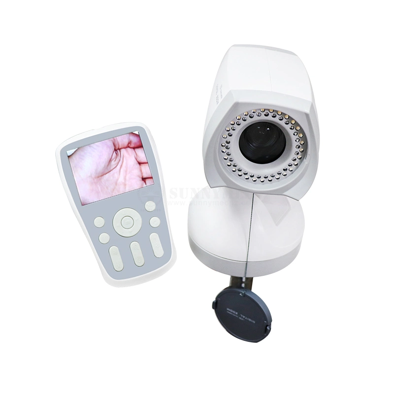 Sy-F005 Cheap Price Medical Potable Gynecology Examination Vagina Colposcope Video Colposcope
