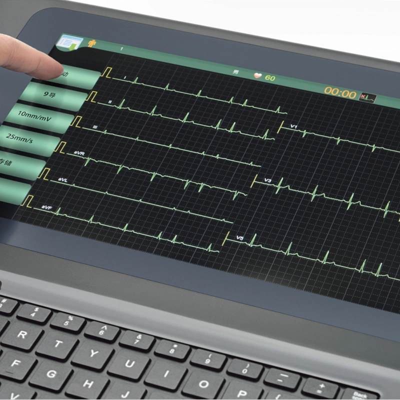 La norma ISO13485 aprobó 12 canales, máquina de ECG portátil con pantalla a color