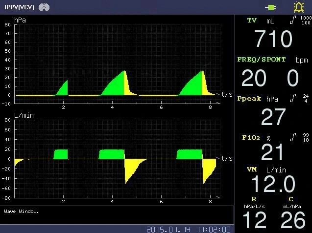 Perlong Puao Top Model Jinling-850 Adv. La anestesia respirador Pcv Vcv CPAP