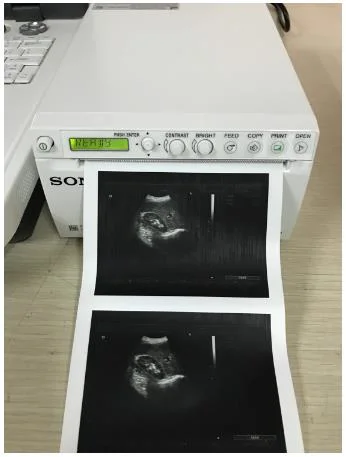 Sony B/W Video Graphic Printer, Ultrasound Printer (UP-X898MD)