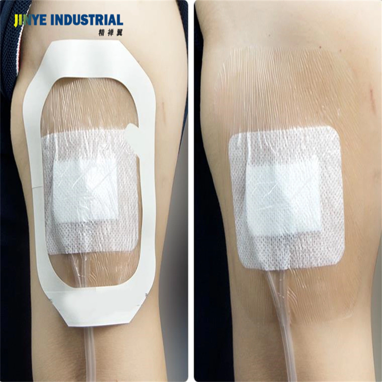 Adhersive Gauze Wound Dressing Transparent Adhesive Individual Packing Wound Covering