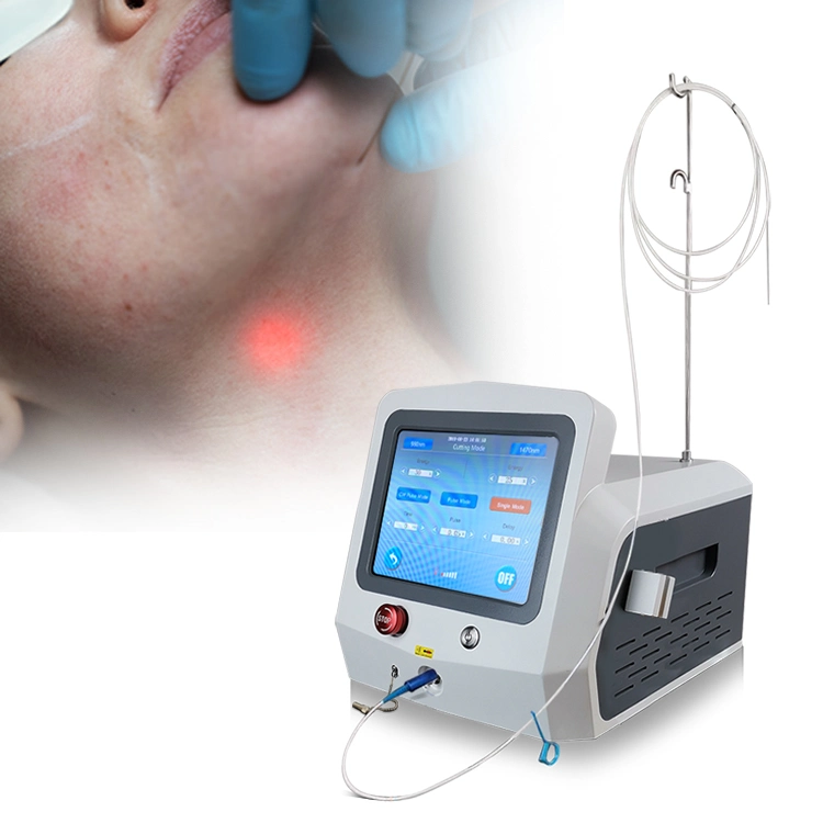 Eyelid Removal Skin Lifting 980nm 1470nm Hot Sale Facial Lifting Medical Device
