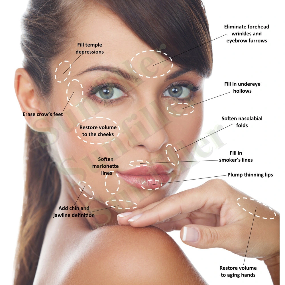 Sunfiller Deeper Line Cross-Linked Dermal Filler Injection Hyaluronic Acid for Facial Contouring