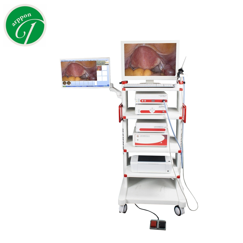 Monitor médico endoscópico sistema de torre de pantalla LCD para histeroscopia artroscopia Urología Anorrectal