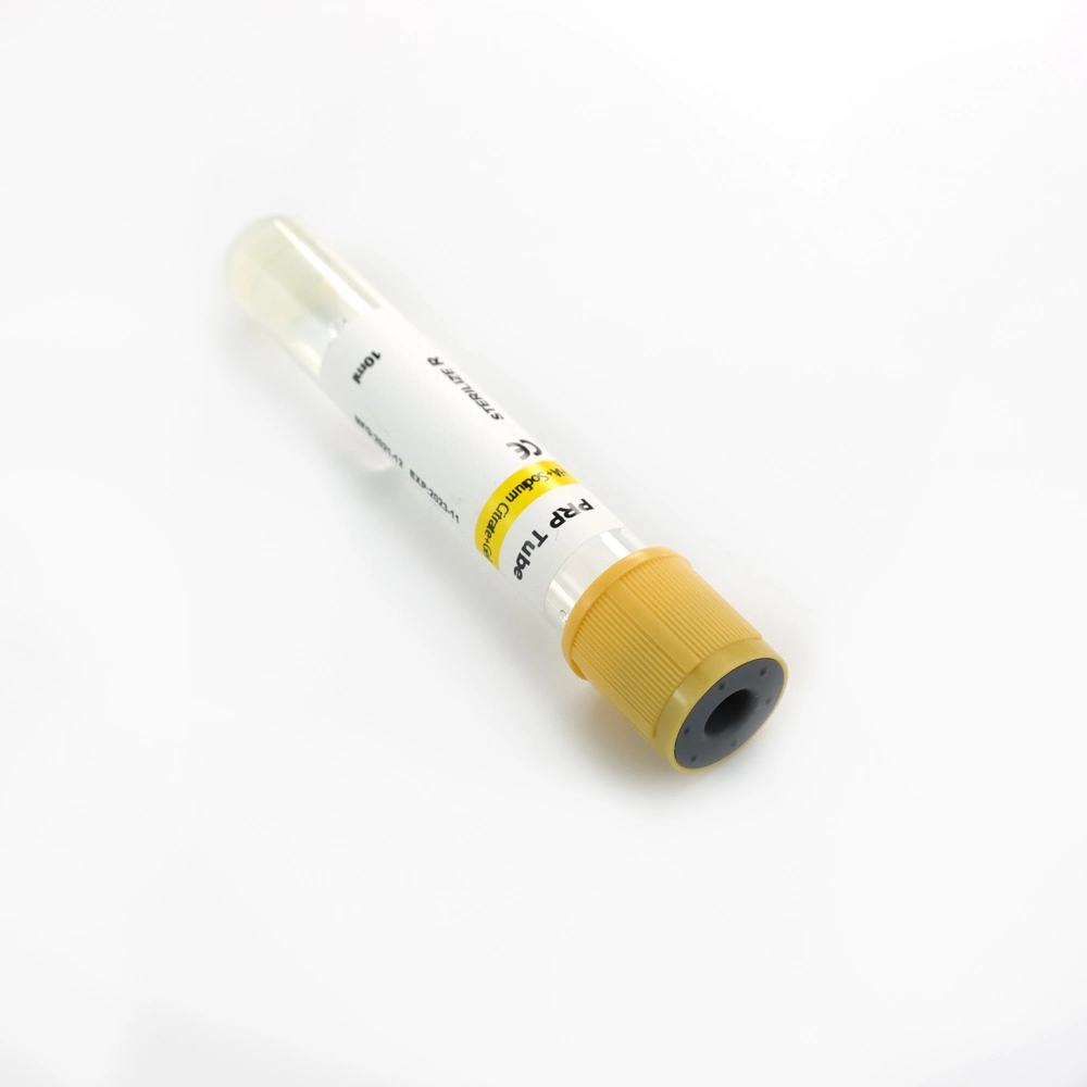 Siny Sodium Fluoride Tube Glucose Tube Disposable Test Instrument Supplies Supply Medical Blood Tube OEM