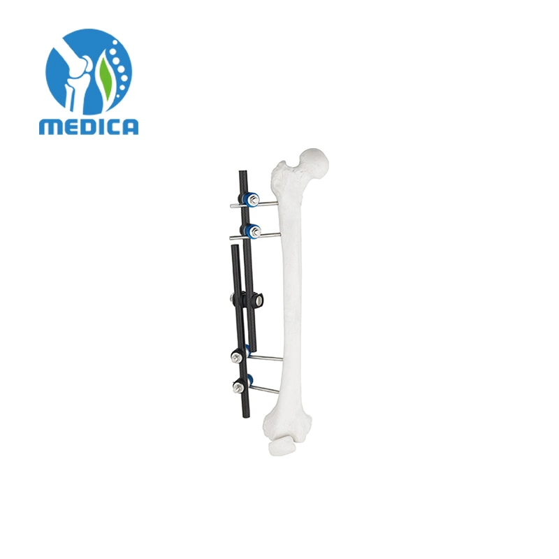 Combination Orthopedic Surgical External Fixation for Femur&Tibia Straight Frame Type Fixator