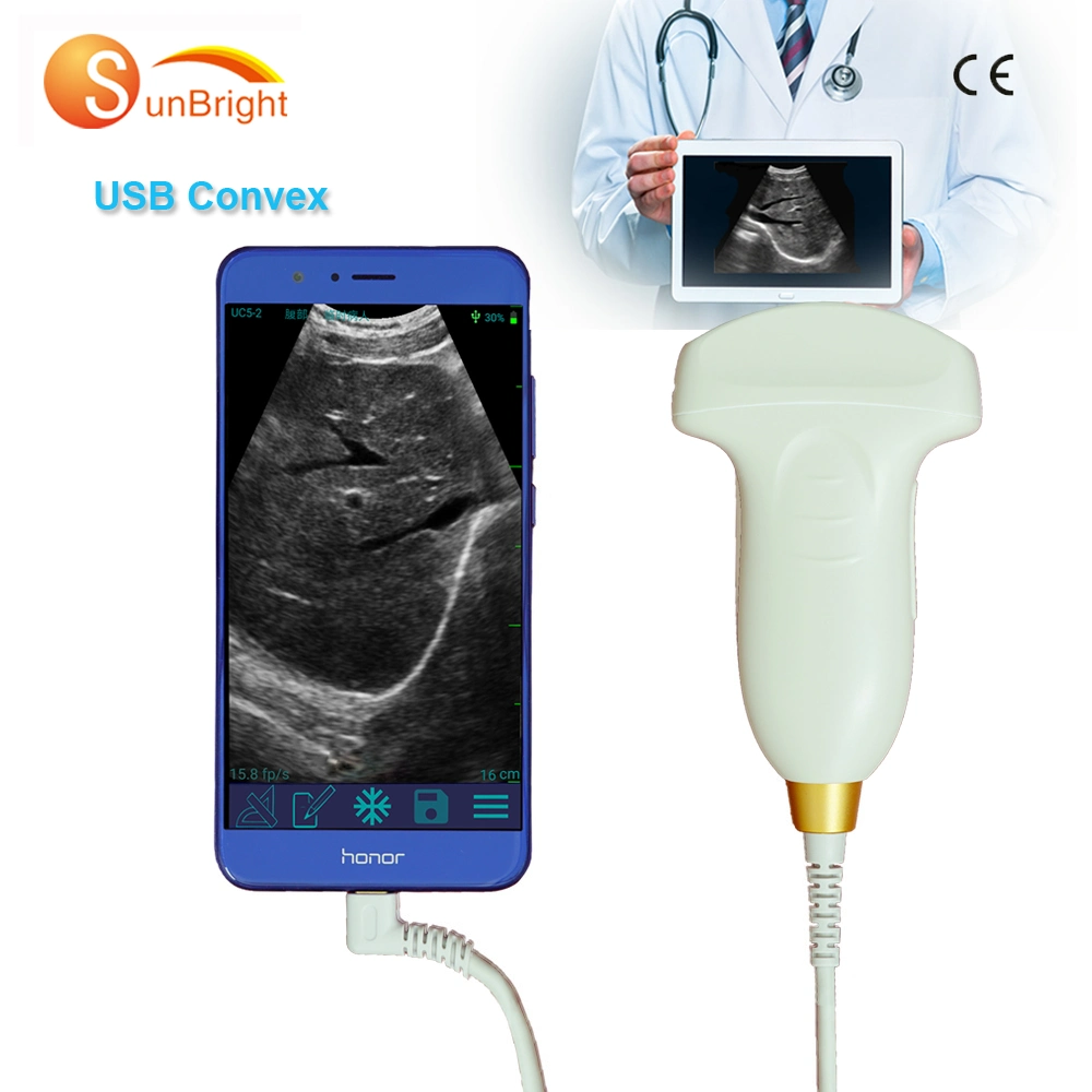 Portable Medico Ultrasound USB Convex Probe Sunbright Ultrasound Scanner Color Doppler