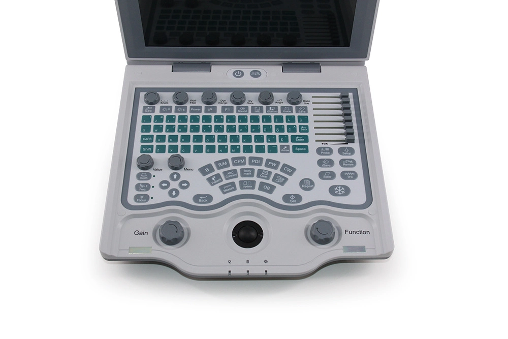 Original Factory Supply U1 B Mode G11 Full Digital Color Doppler Ultrasound Scanner Machine