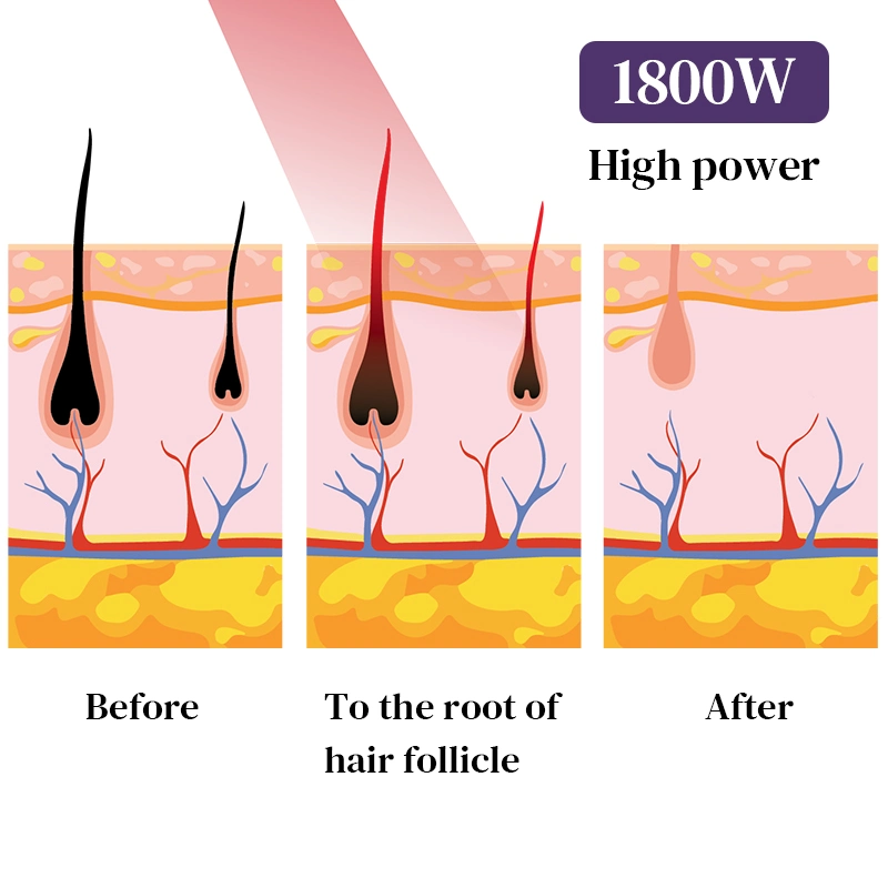 Precio Inicio utiliza el diodo láser la Depilación Láser Portabl Diod los productos de belleza para mujeres