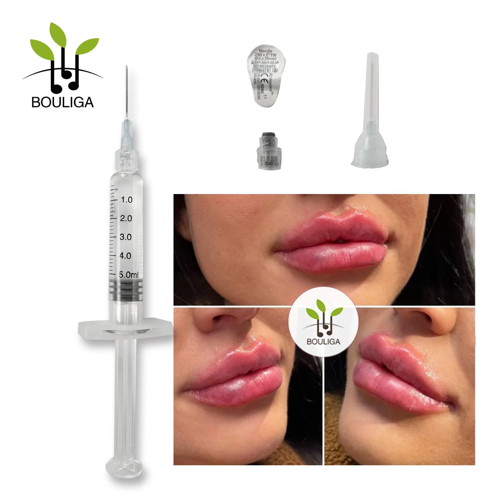 1ml Cross-Linked Hyaluronic Acid Dermal Filler for Facial Rejuvenation