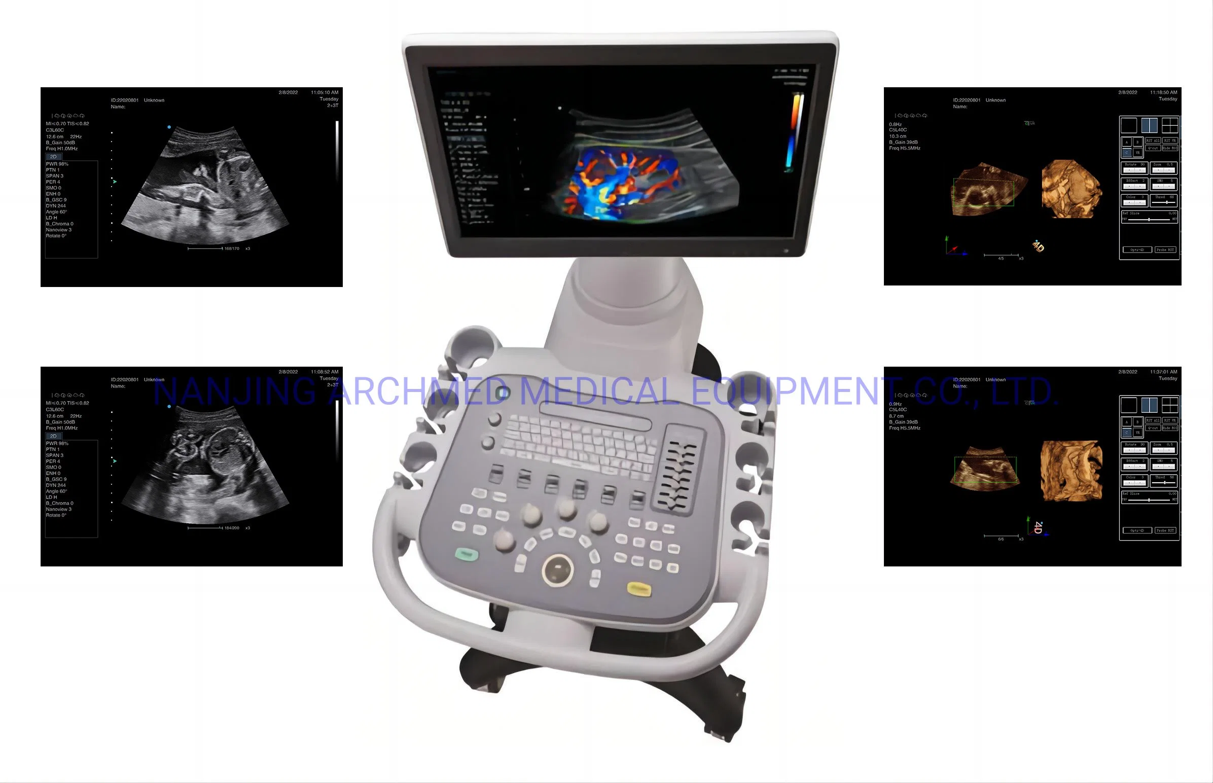 Equipement médical système de diagnostic Doppler couleur portable entièrement numérique échographie Échographe avec moniteur LCD 18.5′