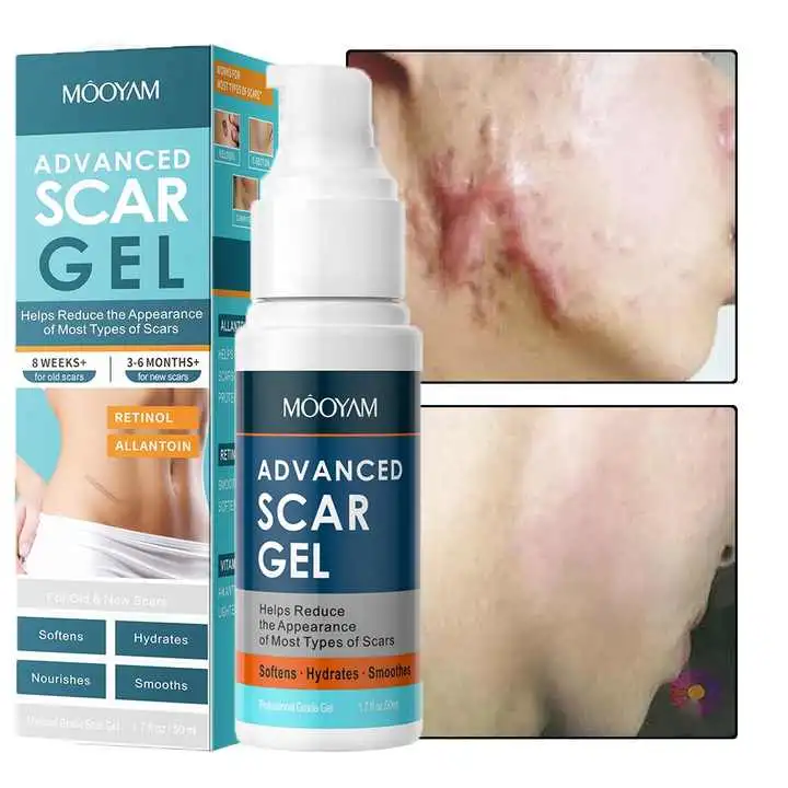 Advanced Silicone Scar Removal Cream Silicone Gel for New Scar Old Scar