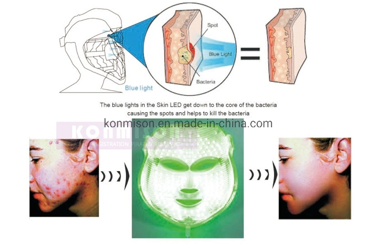 7 LED Lights PDT LED Therapy Facial Mask for Skincare