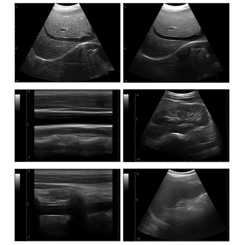 Medizinische Diagnosegereichte Laptop Farbdoppler Ultraschallscanner