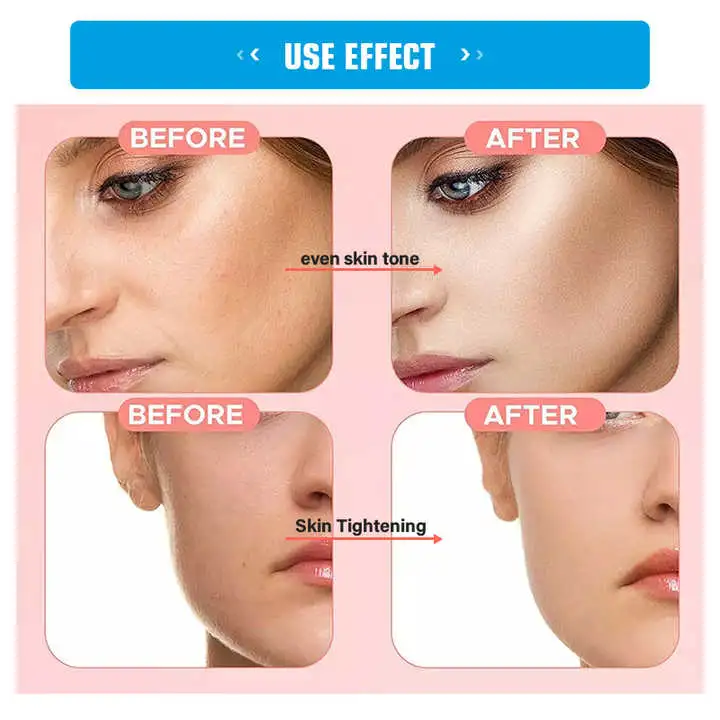 أصلح علاج حب الشباب Essence Moisturizing عضوية Vitamin C Facial المصل