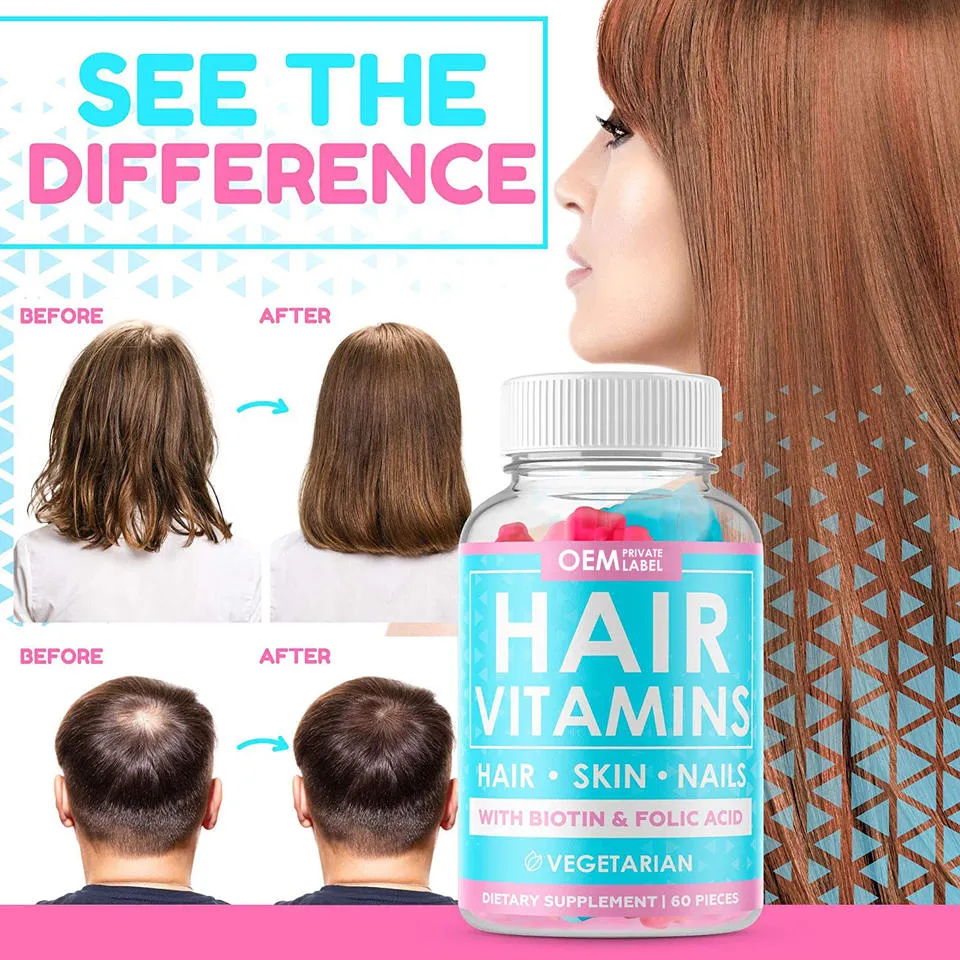 Private Label Gummy vitaminas crescimento do cabelo e cuidados de saúde suplementos para Desenvolvimento da promoção