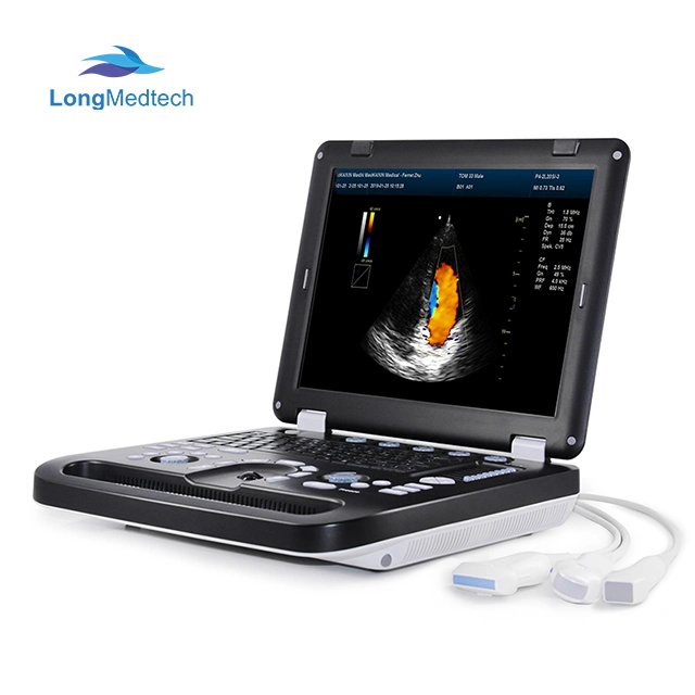 Tragbarer Laptop Voll-Digital-Farbdoppler-Ultraschalldiagnostikinstrumente