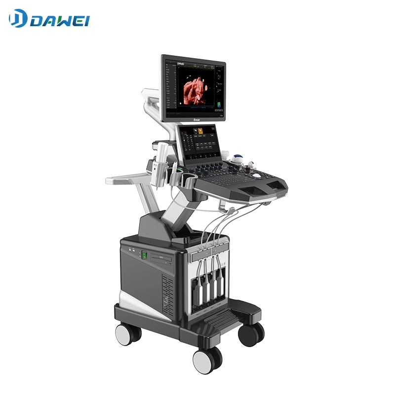 Échographie Doppler couleur 3D/4D/5D en hôpital