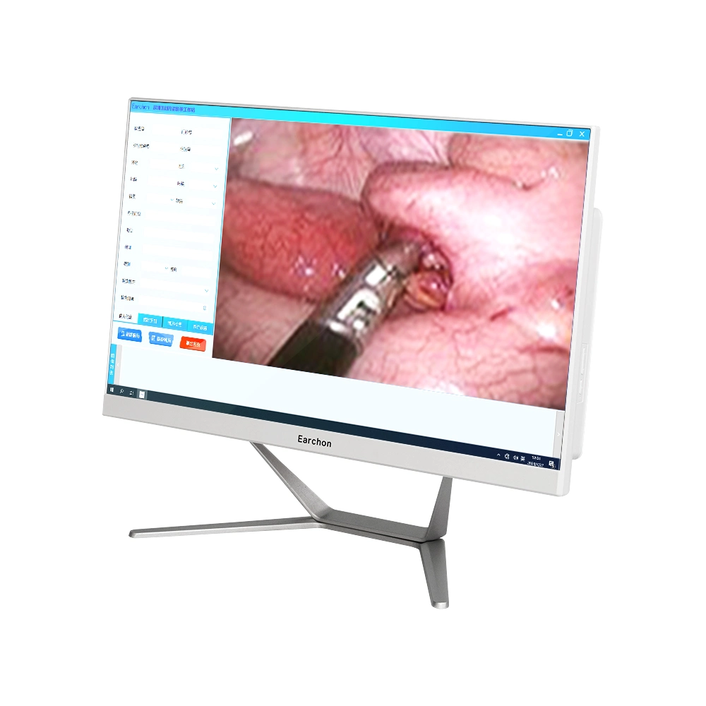 أدوات جراحة التنظير التآفي HD Endoscopic نظام المنظار الداخلي القابل للاستخدام مرة واحدة