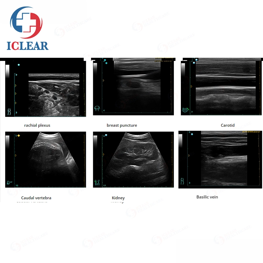 Portable Full-Digital Ultrasound System Notebook B/W Medical Ultrasound Scanner