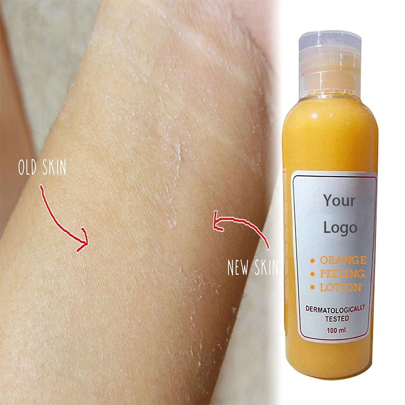 Most Effective Orange Peeling Lotion for Black Skin Whitening