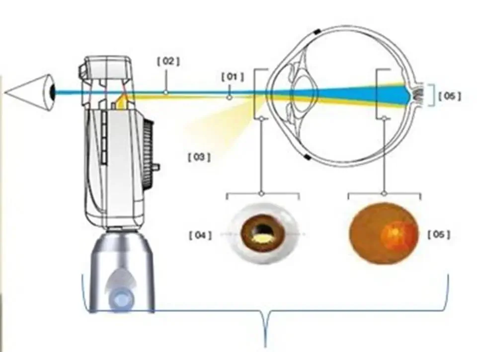 Juego de oftalmoscopio directo médico y otoscopio de fibra óptica