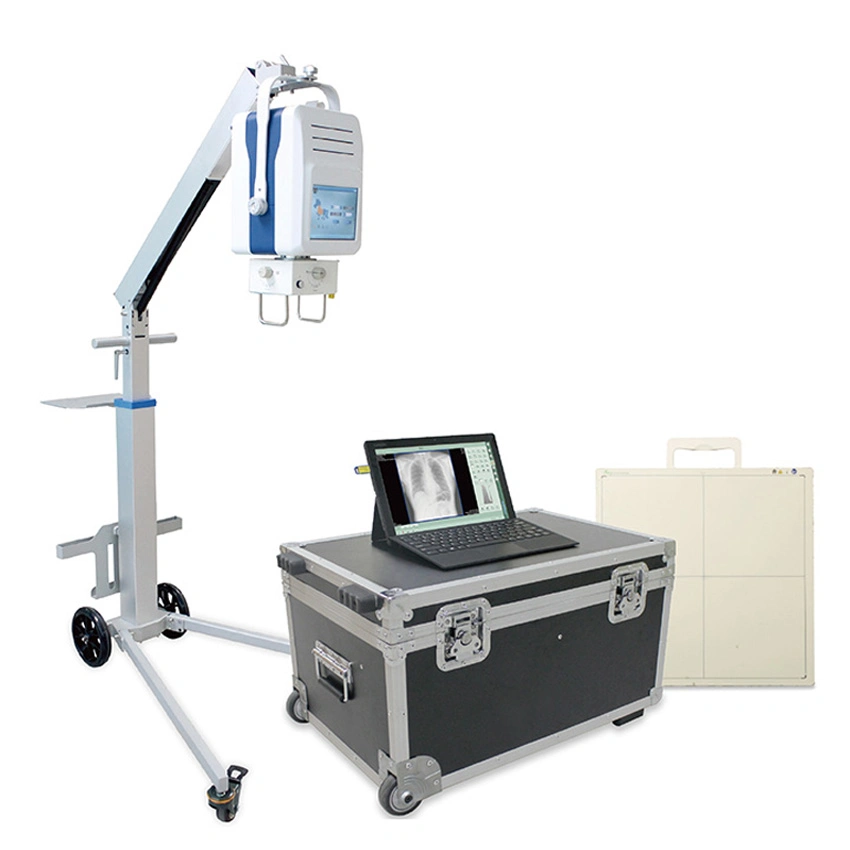 My-D049r Medical Hospital Instrument Portable Mobile Digital X-ray Equipment