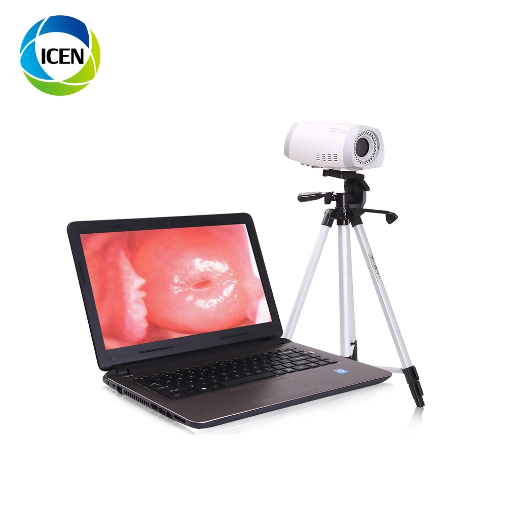 In-G9800 Medical Hospital Digital Video Colposcope for vagin Gynécologie