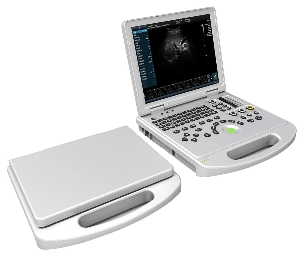 15 Inch LED Medical Display Able to Reverse It Above 160 Degree Portable Ultrasound Machine