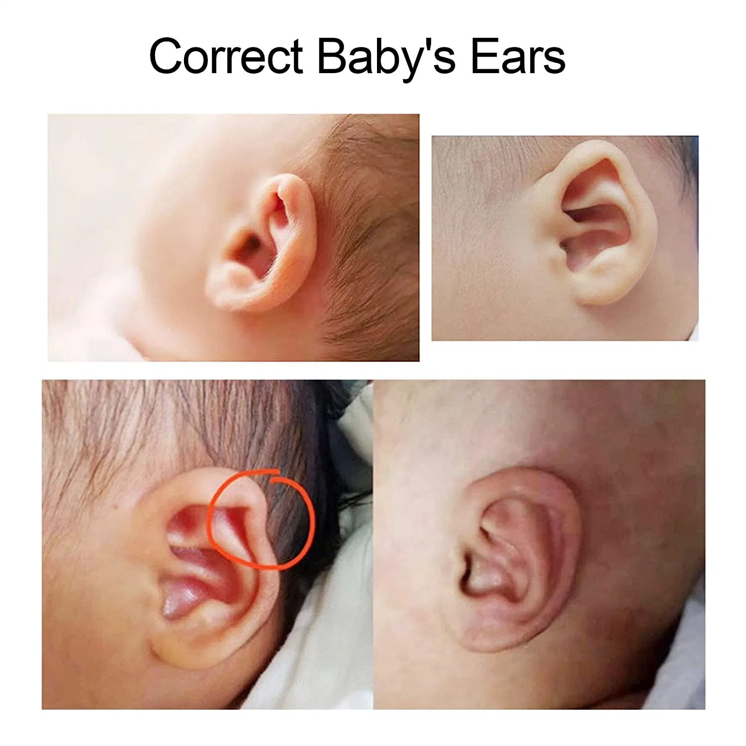 Protector de correção para bebé, autocolantes para protectores para ouvidos de recém-nascidos, fita para a orelha em silicone