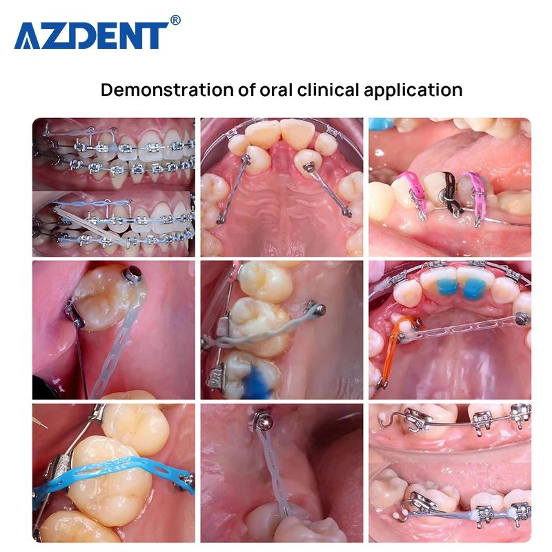 Dentario Ortodóntico caucho elástico cadena de poder tirantes bandas corto/largo/cerrado