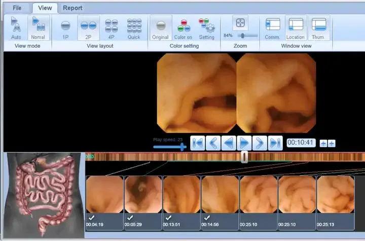 Medical Capsule Endoscopy System