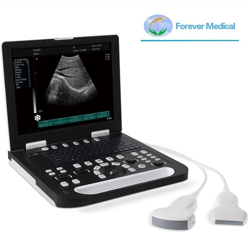 2023 Hot Lightweight Laptop Ultrasonic System Sonography 3D Veterinary Pregnancy Test 15" Large Screen Vet Ultrasound Price