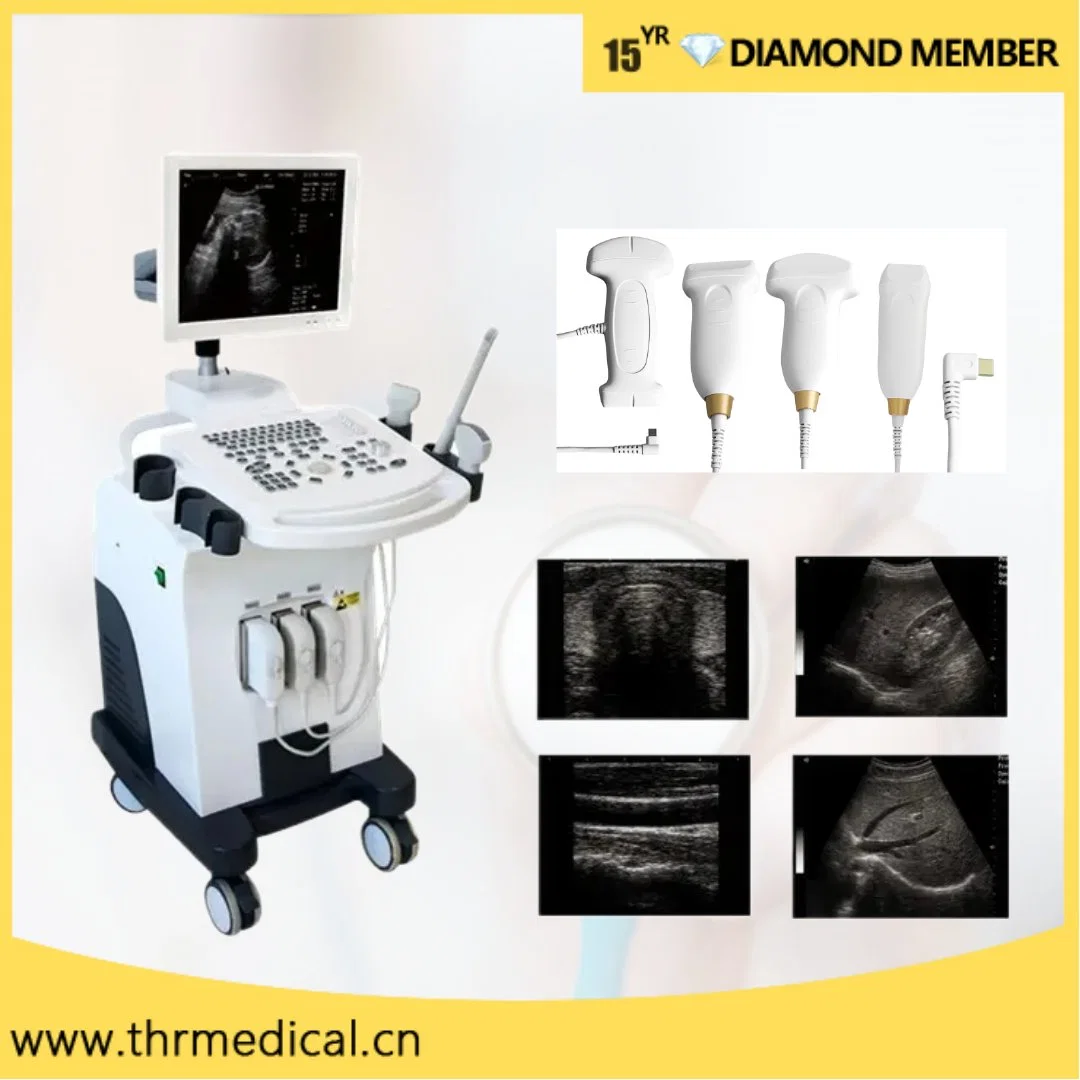 CE Approved Full Digital Trolley B/W Ultrasound Scanner Machine (THR-US370)