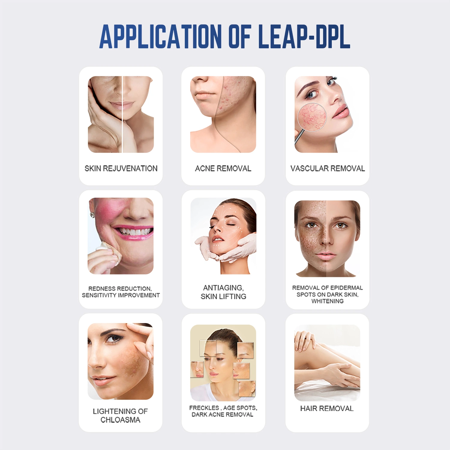 2023 Super láser fotón 3 gestiona Dpl IPL Hair Removal Machine Auricular de rejuvenecimiento de la piel la belleza de la armonía del equipo XL PRO DPL OPC.