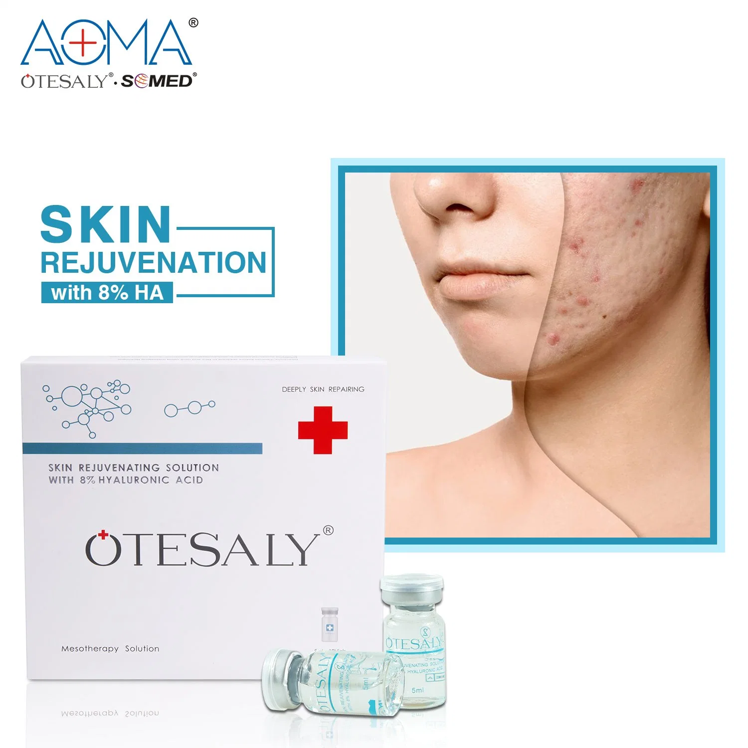 Otesaly Original 5ml 10vials Injectable Mesotherapy Reduce Fine Lines Anti Aging Skin Rejuvenation Hydration Mesotherapy Ampoules