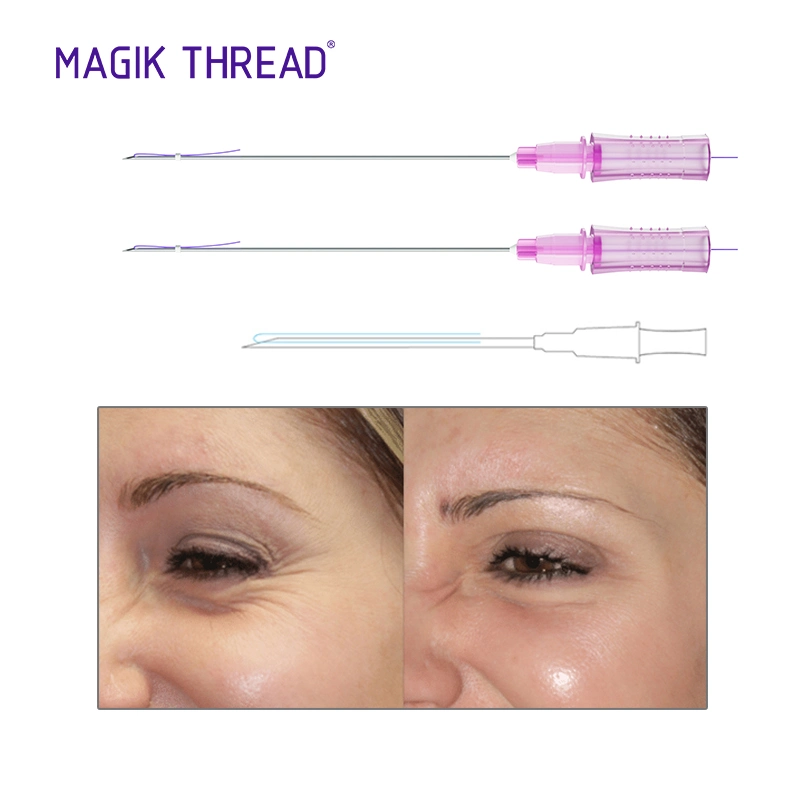 Facelift Products Pdo Threads Under Eyes 3D 4D 6D Cog Lift Pdo Meso Threads