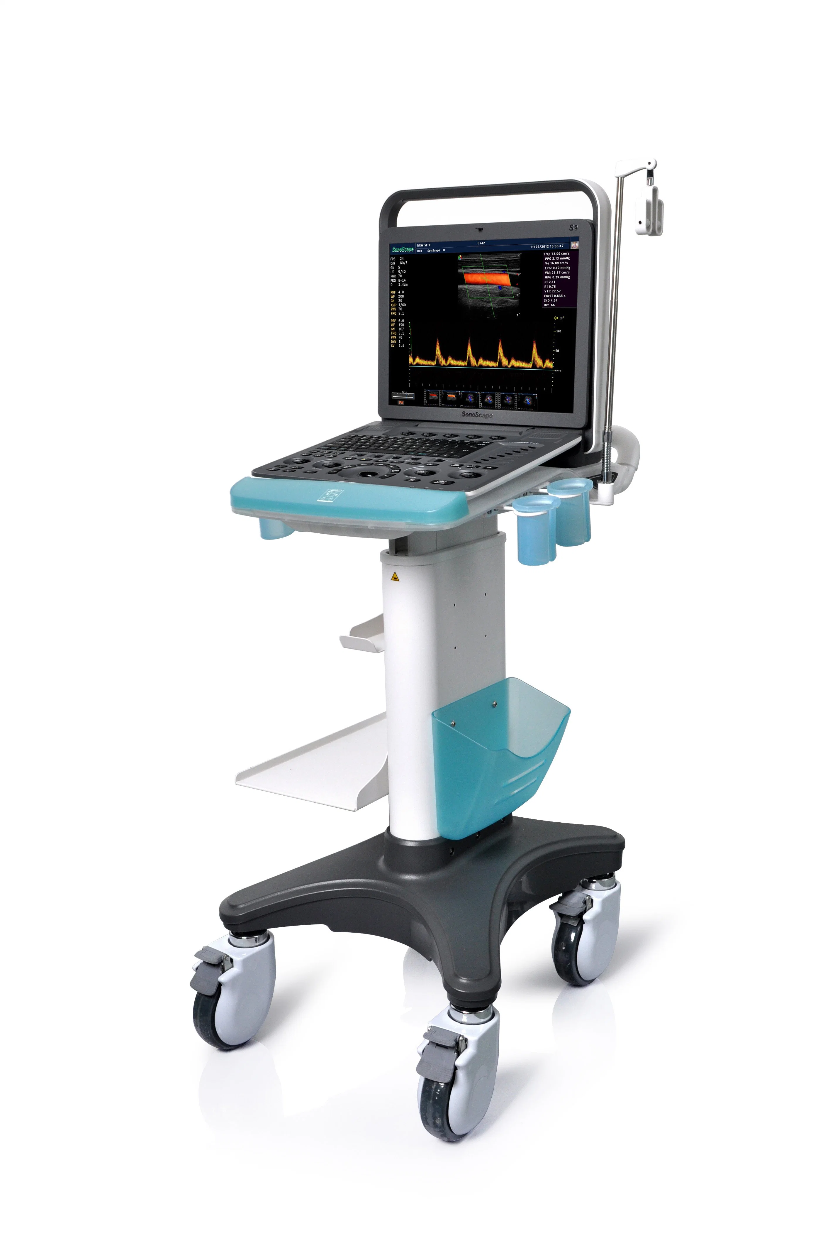 Sonoscape 5D Echo Machine Ultrasound Scanner with Convex Linear Cardiac Transducers for Pregnancy S8 S9 Price