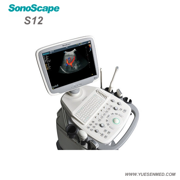 Hospital Medical Trolley 4D Color Doppler Sonoscape S12