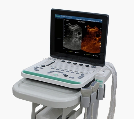 Ss-9 PC Based Laptop Ultrasound B Scanner (Ultrasound Ultrasonic Scanner)