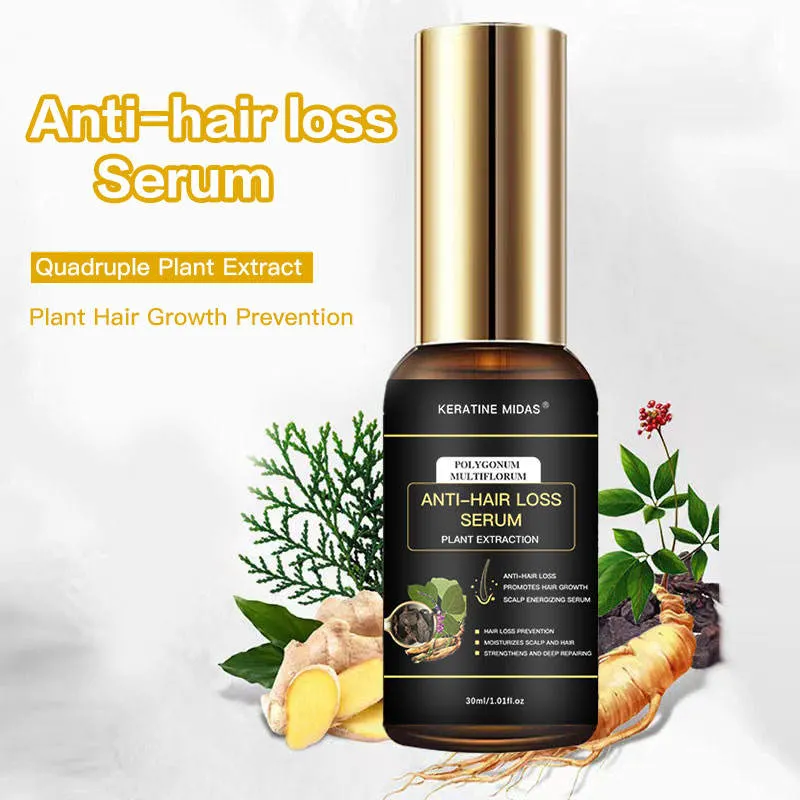 Hair Thinning Loss Products Nourish Remove Dandruff Anti Hair Loss