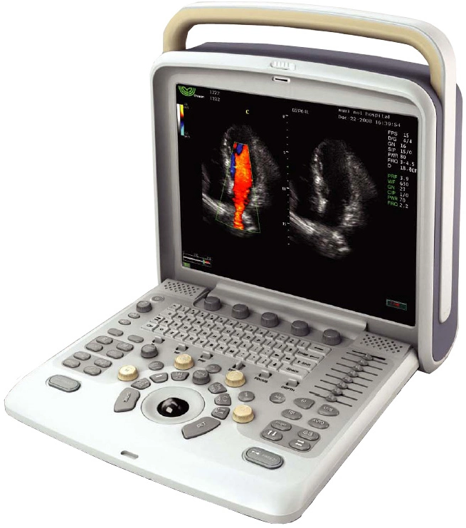 Factory Price Portable Color Portable Ultrasound Scanner