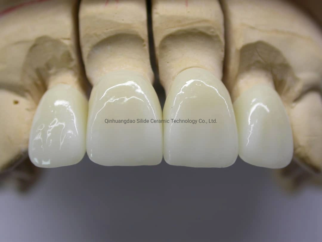 Kingch Multilayer Dental Zirconia Blanks for Dental Lab